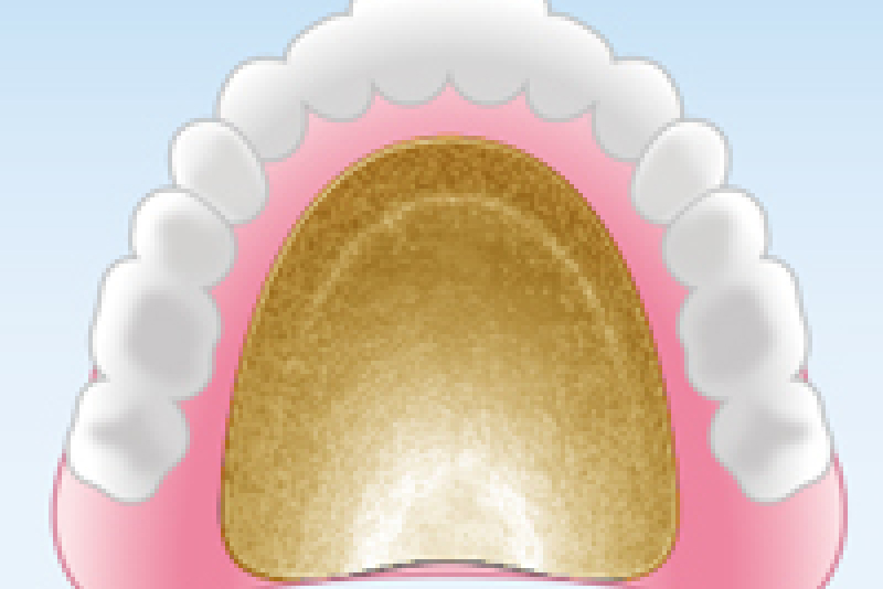 ハイグレードタイプ