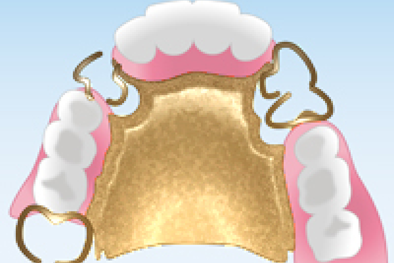ハイグレードタイプ