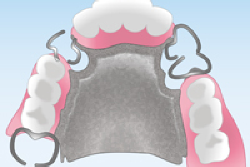 スタンダードタイプ